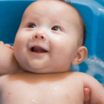 Bé bị chàm sữa, nguyên nhân và cách điều trị hiệu quả tại nhà